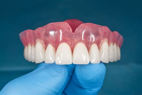 protese dentaria-1